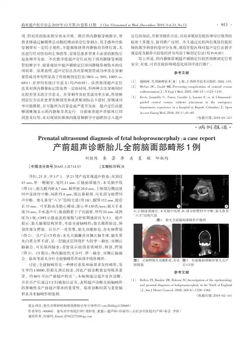 产前超声诊断胎儿全前脑面部畸形1例