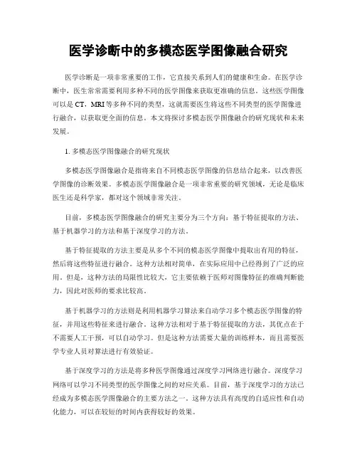 医学诊断中的多模态医学图像融合研究