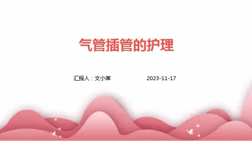 气管插管的护理