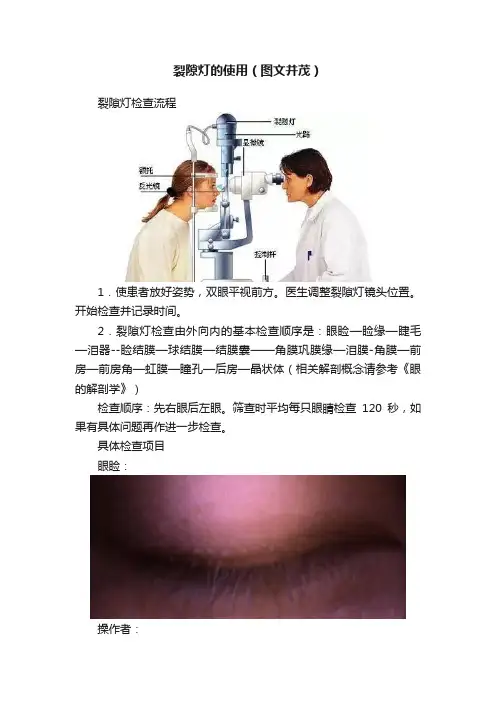 裂隙灯的使用（图文并茂）