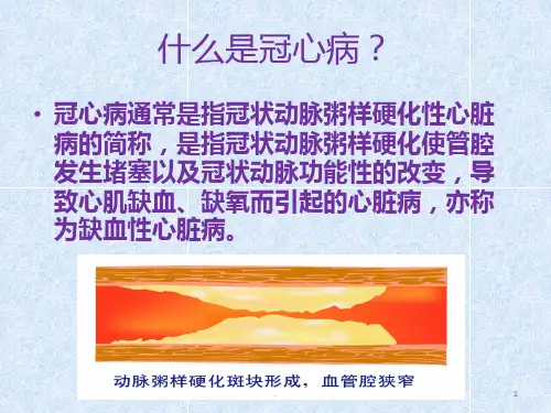 小讲课冠心病PPT课件
