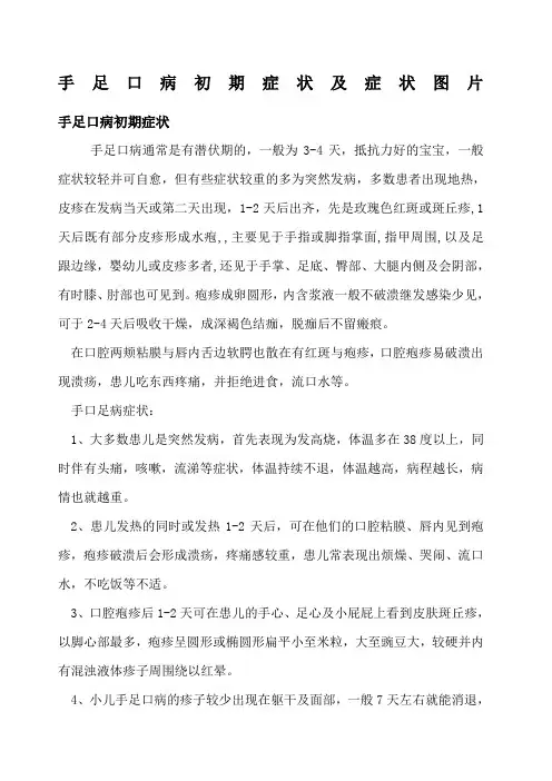 手足口病初期症状与预防措施及症状图片
