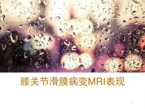 膝关节滑膜病变MRI表现PPT课件