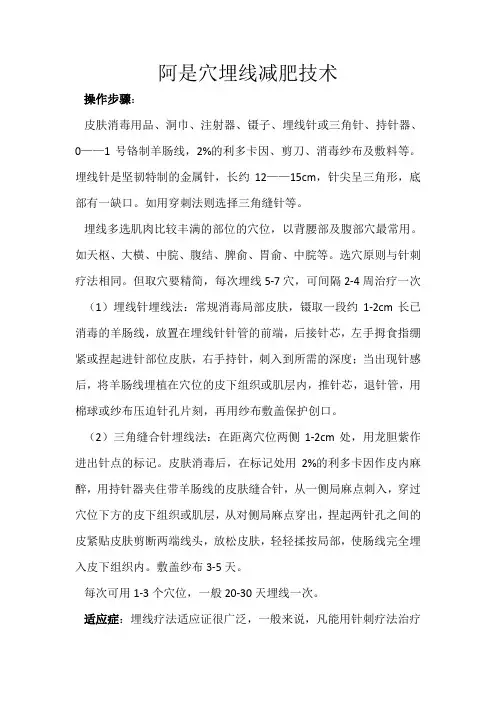 阿是穴埋线减肥技术