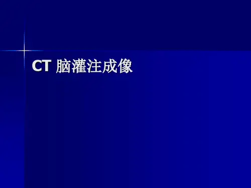 CT脑灌注成像