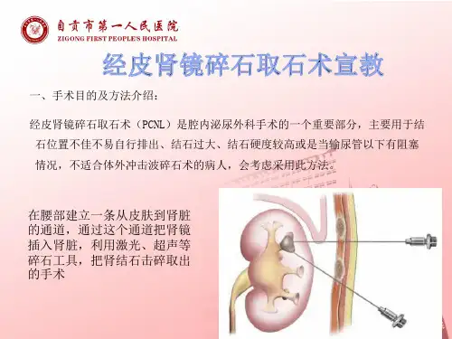 经皮肾镜碎石取石术宣教PPT课件
