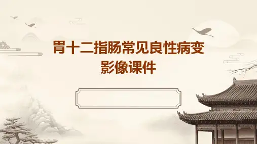胃十二指肠常见良性病变影像课件