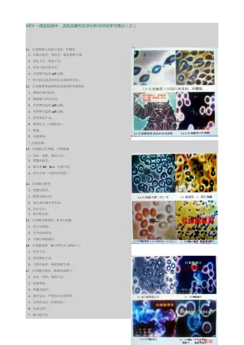 MDI一滴血检测中