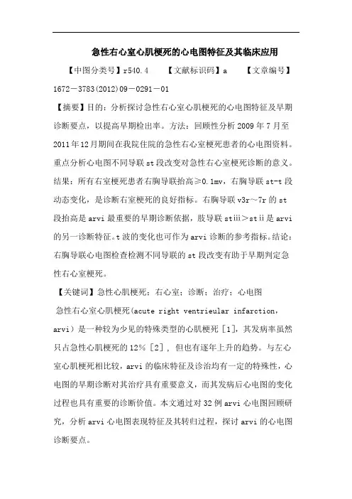 急性右心室心肌梗死心电图特征其临床应用论文