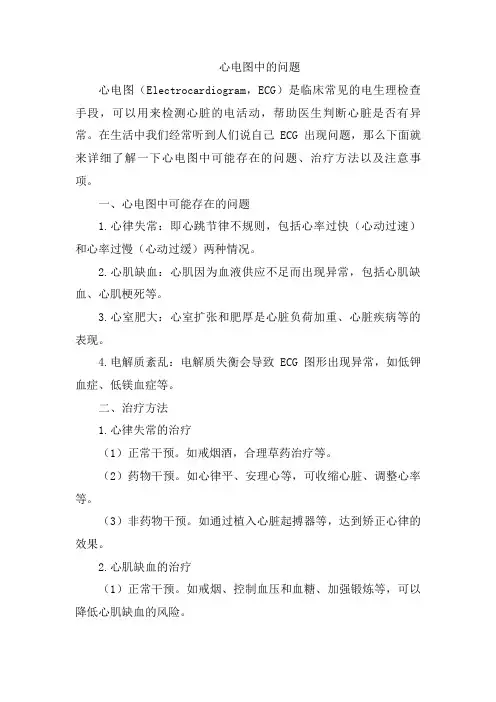 心电图中的问题