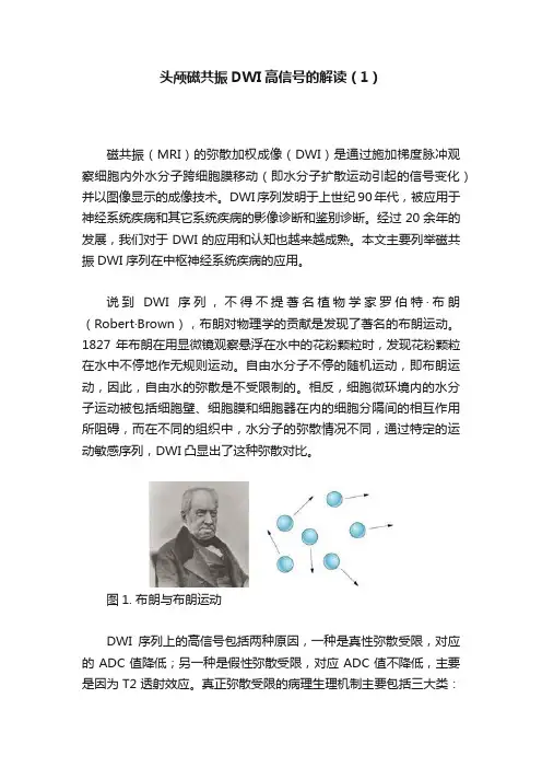 头颅磁共振DWI高信号的解读（1）