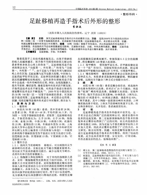 足趾移植再造手指术后外形的整形