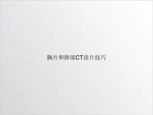 胸片和肺部CT读片技巧PPT实用版
