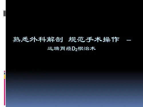 胃癌D2根治术