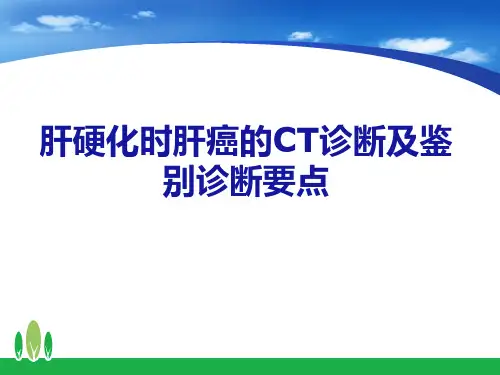 肝硬化背影下肝癌的CT诊断及鉴别诊断要点