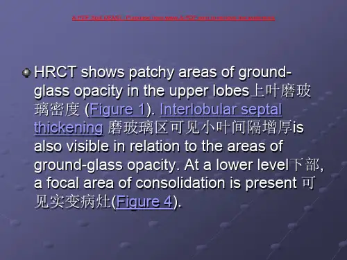高分辨率肺部CT_0601-0630