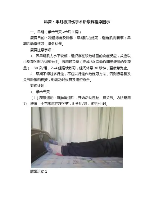 科普：半月板损伤手术后康复程序图示