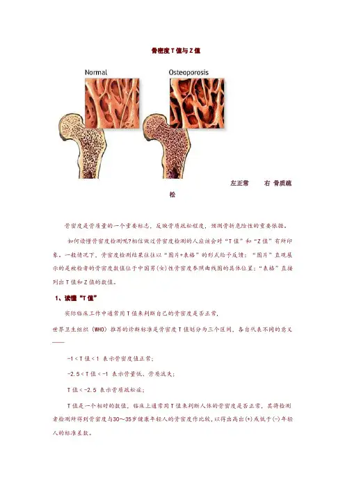 BMD超声骨密度参数及报告单说明