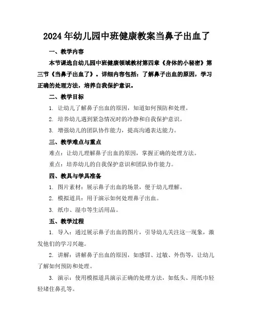 2024年幼儿园中班健康教案当鼻子出血了