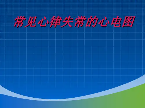 常见心律失常的心电图 (推荐)