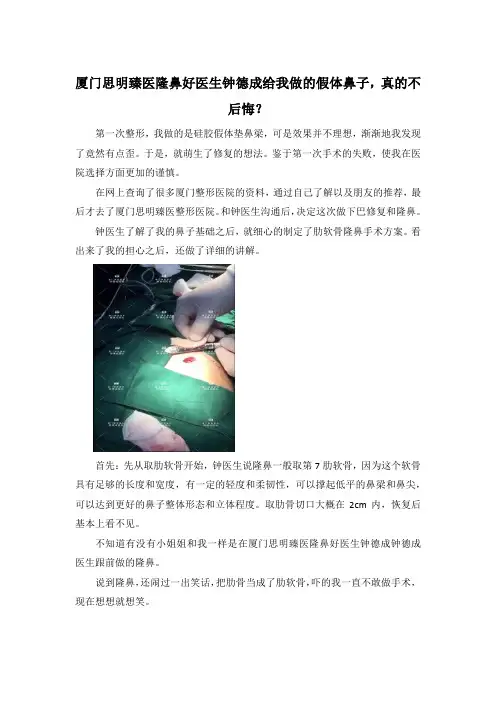 厦门思明臻医隆鼻好医生钟德成给我做的假体鼻子,真的不后悔？