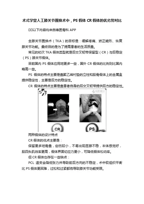 术式学堂人工膝关节置换术中，PS假体CR假体的优劣势对比