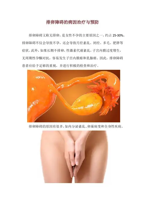 排卵障碍的病因治疗与预防