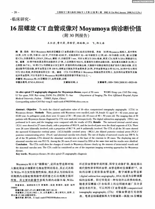16层螺旋CT血管成像对Moyamoya病诊断价值(附30例报告)