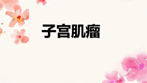 子宫肌瘤PPT课件