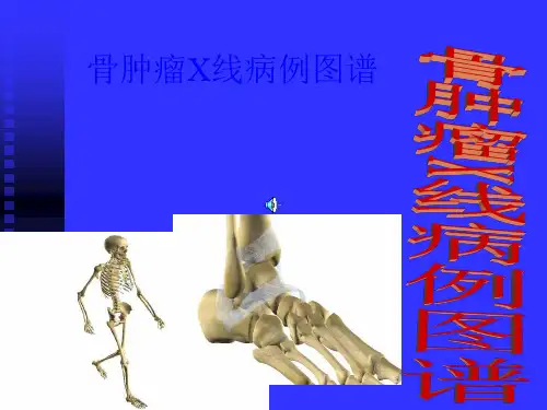 骨肿瘤X病例图谱解析