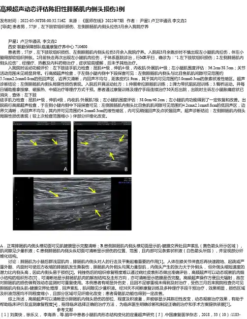 高频超声动态评估陈旧性腓肠肌内侧头损伤1例