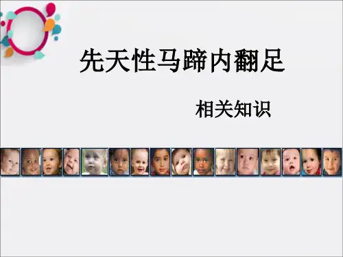 先天性马蹄内翻足相关知识ppt课件
