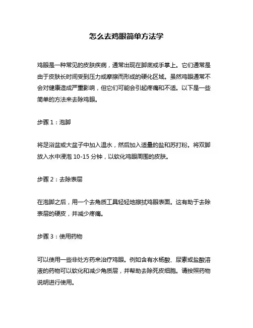 怎么去鸡眼简单方法学