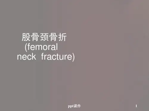 股骨颈骨折  ppt课件