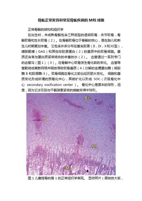 骨骺正常发育和常见骨骺疾病的MRI成像
