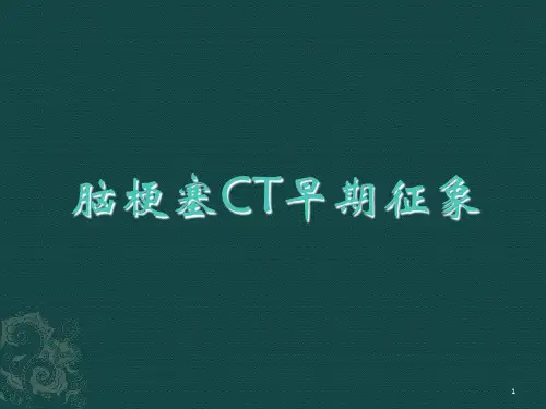脑梗塞CT早期征象9ppt课件