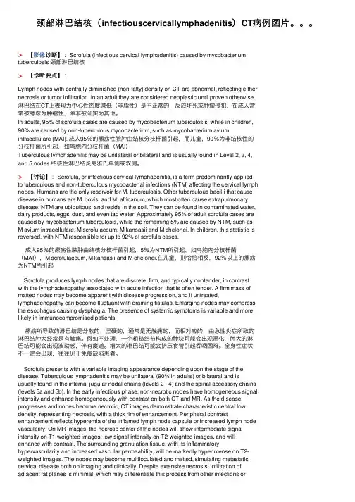 颈部淋巴结核（infectiouscervicallymphadenitis）CT病例图片。。。