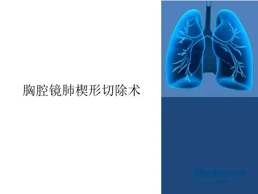 胸腔镜肺楔形切除术演示教学