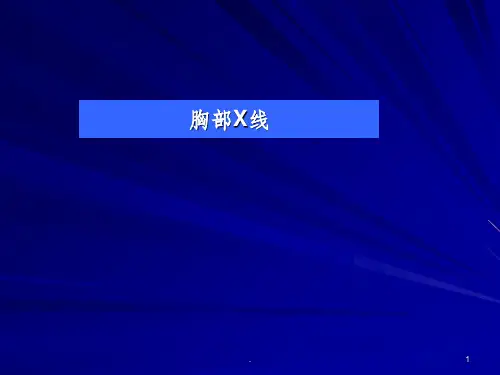胸部X线诊断ppt课件