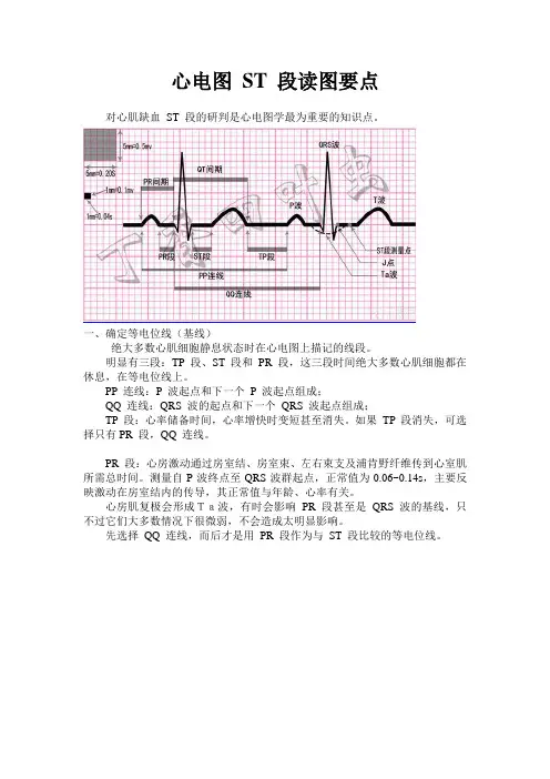 心电图ST段要点