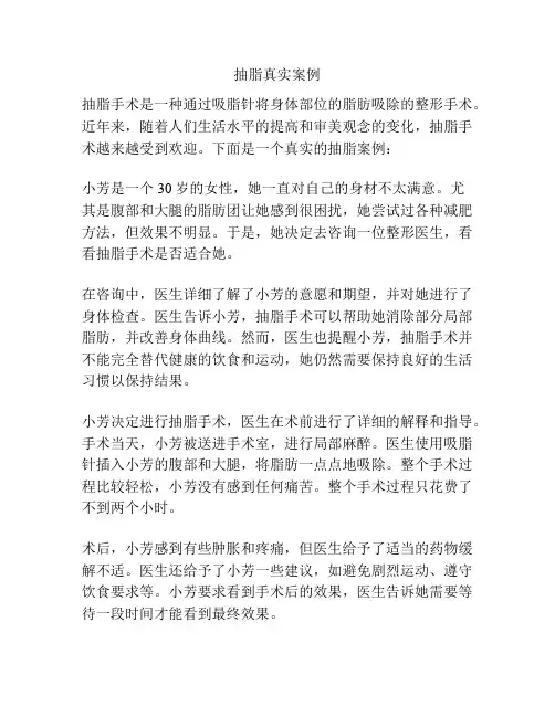 抽脂真实案例