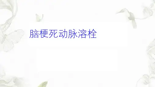 脑梗死动脉溶栓ppt课件