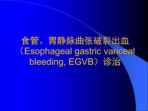 食管、胃静脉曲张治疗