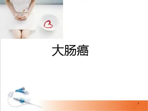 (医学课件)大肠癌PPT幻灯片