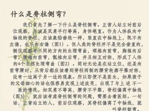 脊柱侧弯诊断及治疗PPT课件