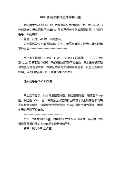 MRI如何诊断少量蛛网膜出血