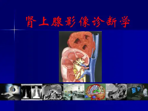 图文详解完整版-肾上腺疾病