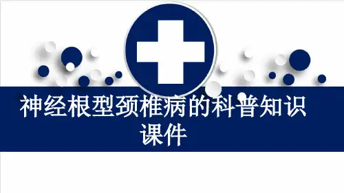 神经根型颈椎病的科普知识课件