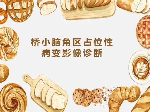 桥小脑角区占位性病变影像诊断