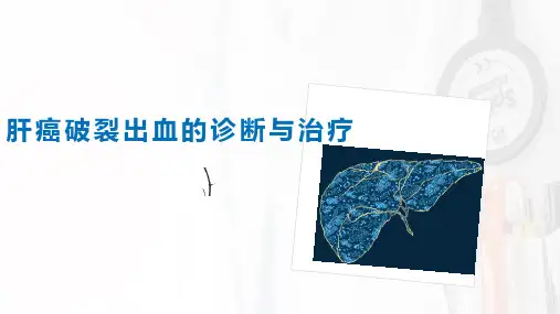 肝癌破裂出血治疗